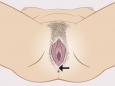 Órganos sexuales visibles de una mujer con indicación del perineo
