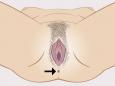 Órgãos sexuais visíveis de uma mulher com indicação do ânus