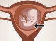 Foetus in uterus surrounded by amniotic fluid
