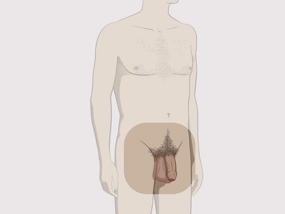 cum se va sustrage penisul
