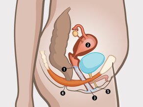 Detaliu al pelvisului femeii: 1. prezervativ feminin, 2. uter, 3. vagin, 4. anus și 5. meatul urinar.