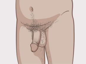 Different penises: example 4