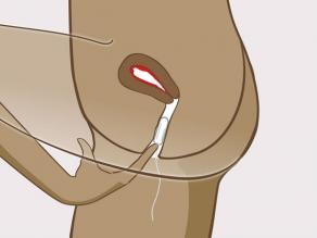 زنی در حال قرار دادن تامپون در واژن خود