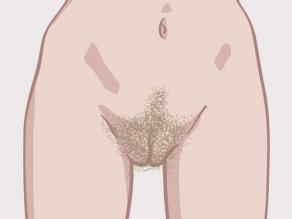 Различни вулви (външните полови органи): пример 1