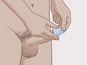 Appuyez sur l’extrémité du préservatif afin de laisser de l’espace pour le sperme et placez le préservatif sur le pénis.