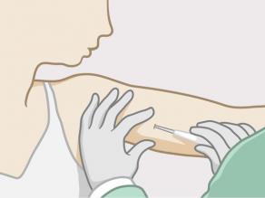 Een dokter brengt het hormonaal implantaat in, in de bovenarm van een vrouw.