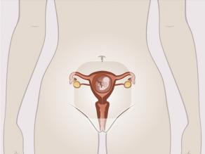 Kobieta w ciąży w pozycji stojącej. Uwagę skupiono na wewnętrznych narządach płciowych i płodzie wewnątrz macicy.