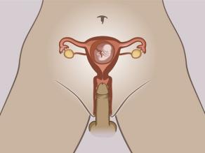 Детайл от вътрешните полови органи на бременна жена. Плодът е вътре в матката. Пенисът прониква във влагалището и не може да достигне до плода.