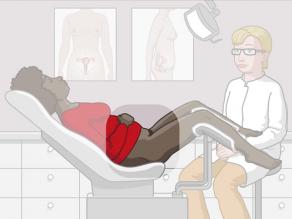 Жена лежи на гинекологичен стол в близост до лекаря. Фокусът е върху корема. 