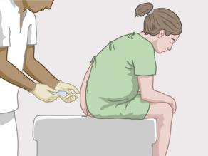 Dokter geeft een epidurale (lokale) verdoving: een injectie in de onderrug om de pijn tijdens de weeën te verzachten.
