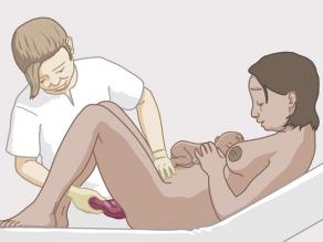 De moederkoek komt uit de vagina naar buiten, 10 tot 30 minuten na de bevalling. 