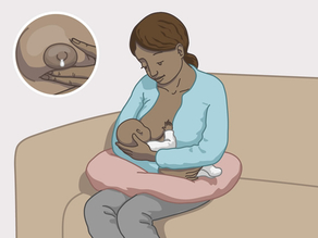 HIV kann beim Stillen über die Muttermilch übertragen werden.