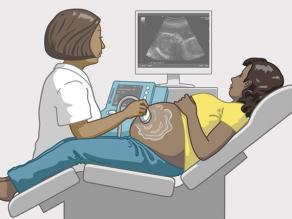 Medic care face o ecografie unei femei însărcinate.