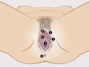 A woman’s visible sexual organs are: 1. outer labia, 2. inner labia, 3. opening of the vagina, 4.clitoris. The urinary meatus (5) and anus (6) are not part of the sexual organs.