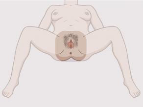 Kobieta w pozycji leżącej z rozłożonymi nogami. Uwagę skupiono na widocznych organach płciowych.